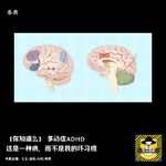 多动症ADHD，这是一种病，而不是我的坏习惯丨你知道么