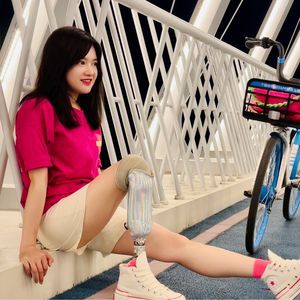 Vol.56 如果未来中国的假肢行业越来越好，请记得每一束和她一样的微光