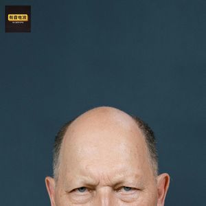 没错我脱发了!我有病!哪些现象,说明心理有问题