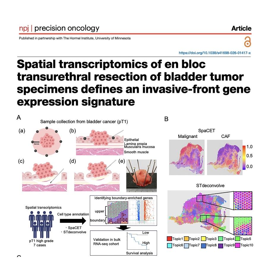 1272-Mapping Invasive-Front Signature of Bladder Cancer episode artwork