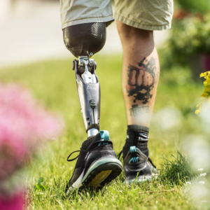 智能假肢：当“义肢”拥有“知觉”