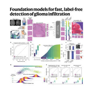 362-FastGlioma: AI for Rapid Tumor Infiltration Detection