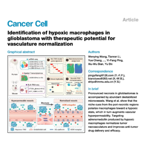 793-Hypoxia-TAM Dynamics in Glioblastoma