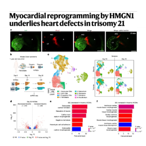 217-HMGN1 Dosage Drives Down Syndrome Cardiac Defects