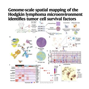 1645-Spatial Mapping in Hodgkin Lymphoma