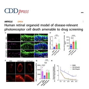 1447-Human Retinal Organoid Model for AMD Drug Screening