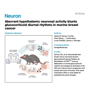 447-Neural Rhythms and Breast Cancer