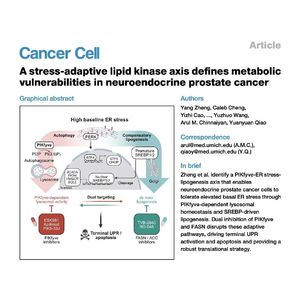 1522-Targeting PIKfyve-ER Stress Axis in Prostate Cancer