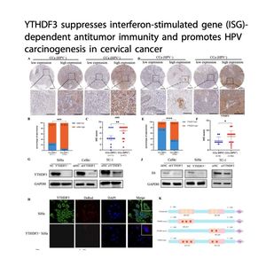 1426-YTHDF3 Promotes HPV Carcinogenesis