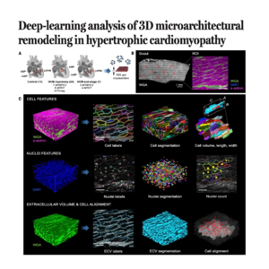 514-CaMVIA-3D分析肥厚型心肌病的三维微结构与基因图谱