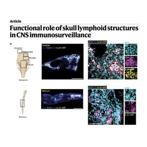 1541-Skull Bone Marrow Lymphoid Structures in CNS