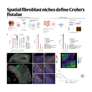 307-Spatial fibroblast niches define Crohn’s fistulae