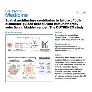 1332-Spatial Transcriptomics for Precision Bladder Cancer