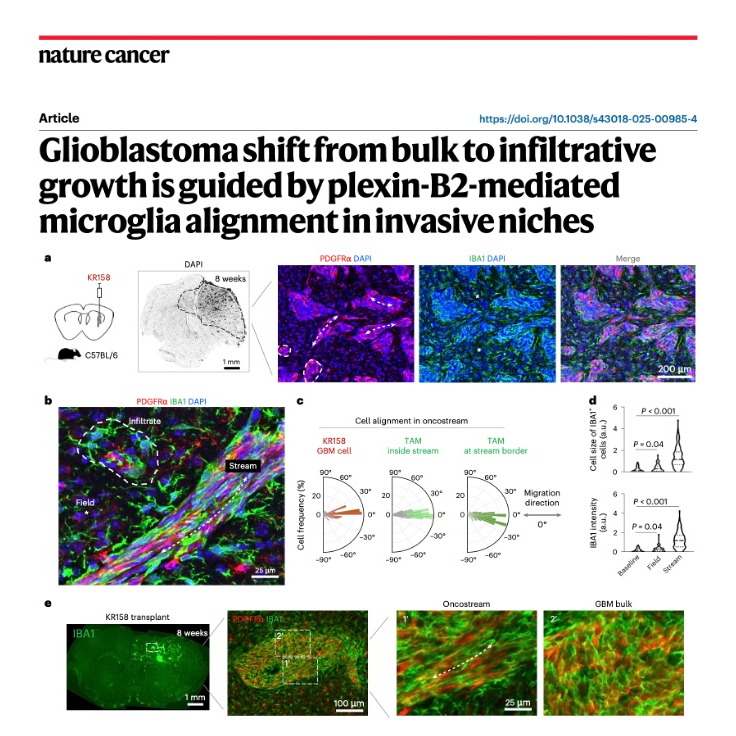 672-Plexin-B2-Mediated Glioblastoma Invasion Tracks episode artwork
