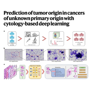 145-TORCH: AI Prediction of Cancer Origin from Cytology