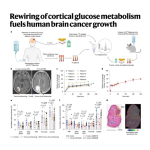253-Rewiring of cortical glucose metabolism fuels GBM growth