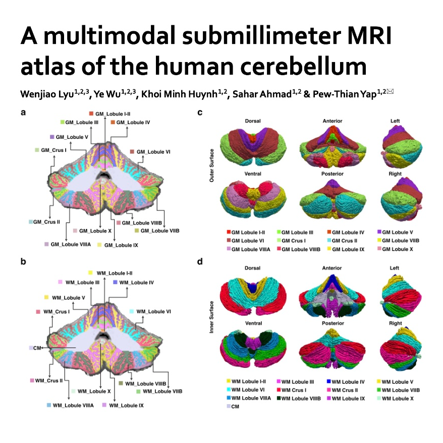 620-Multimodal MRI Atlas of the Human Cerebellum