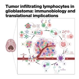 1393-Tumor Infiltrating Lymphocytes in Glioblastoma