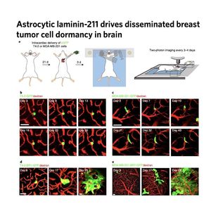 1619-Breast Tumor Cell Dormancy in Brain