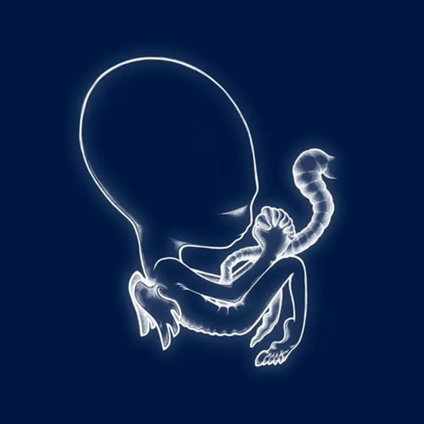 Sigur Rós - Ágætis byrjun episode artwork