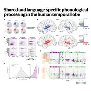 308-Neural Coding of Universal Phonetics and Word Structure