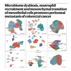 688-结直肠癌腹膜转移的微环境重塑与机制研究