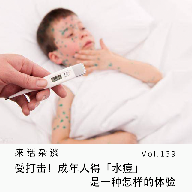 Vol.139 受打击!成年人得「水痘」是一种怎样的体验