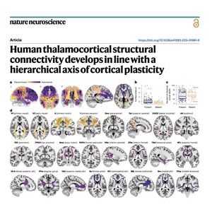 932-Thalamocortical Connectivity of Cortical Plasticity