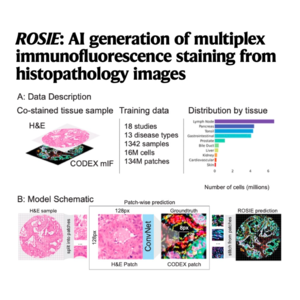 163-ROSIE: AI Multiplex Immunofluorescence from H&E Images