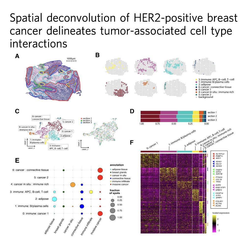 1142-Spatial Cell Interactions in HER2+ Breast Cancer episode artwork