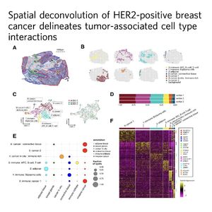 1142-Spatial Cell Interactions in HER2+ Breast Cancer