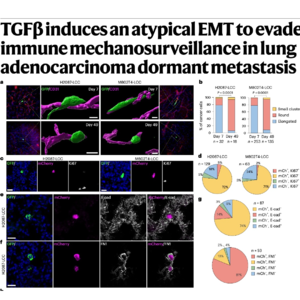 686-非典型上皮间质转化辅助休眠肺癌细胞免疫逃逸