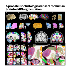 258-NextBrain: Histological Atlas of the Whole Human Brain