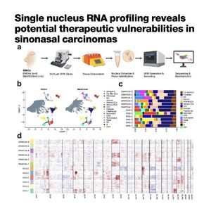 1394-Sinonasal Carcinoma Therapeutic Vulnerabilities