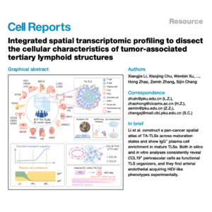 164-Spatial Transcriptomics Dissecting Tumor-Associated TLS