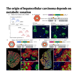 321-Hepatic Zonation Dictates Cancer Initiation
