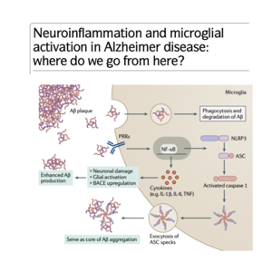 036-Neuroinflammation and microglial activation in AD