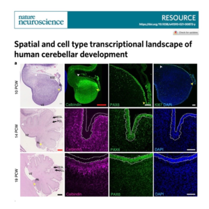 678-人小脑发育的空间与细胞转录图谱