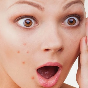 VOL.054青春痘 “赖着不走”？外洗内调巧搭配，跟青春痘 “说拜拜” 没商量