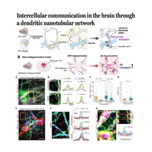 149-Neuronal Communication and Alzheimer's Pathology