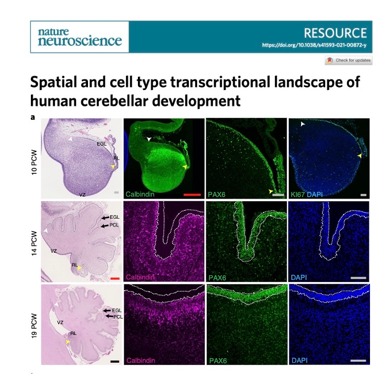 678-Developmental Cell Atlas of the Human Cerebellum episode artwork