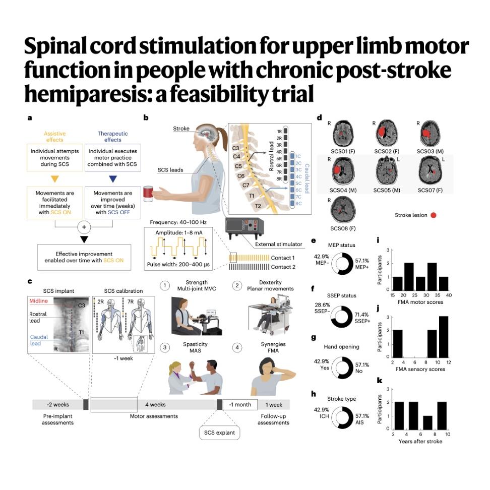 1182-Spinal Cord Stimulation for Post-Stroke Motor Recovery episode artwork