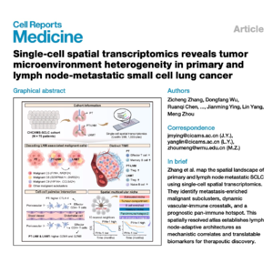 830-Spatial Atlas of Small Cell Lung Cancer Metastasis