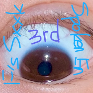 3rd | Protecting your eyes! Even if they’re GENETIC！！！