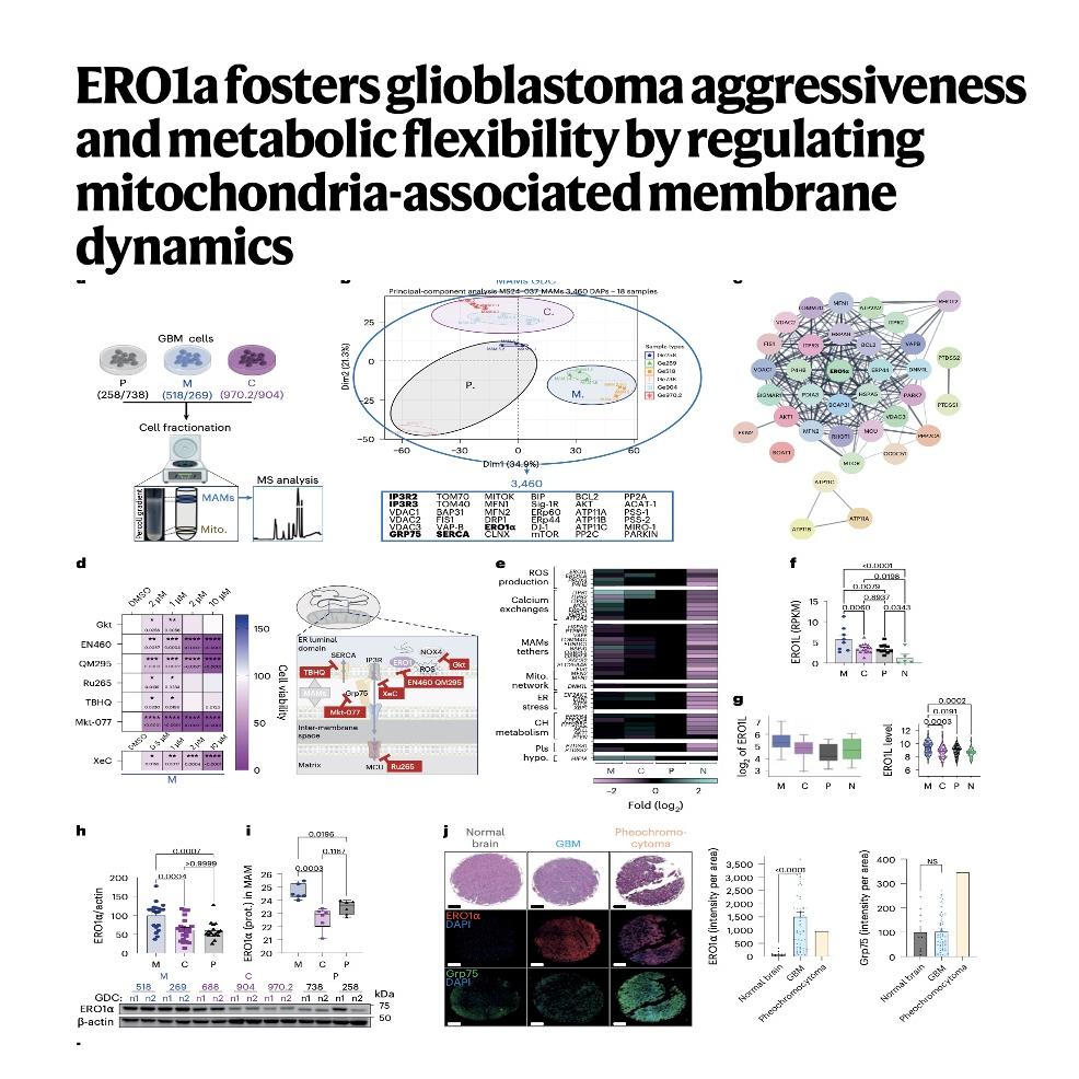 1235-ERO1α Regulation of MAM Dynamics in Glioblastoma episode artwork