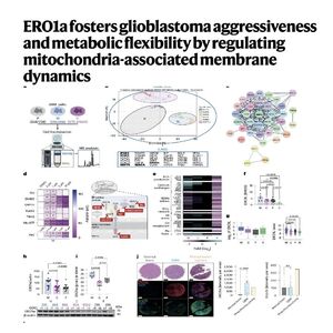 1235-ERO1α 调控胶质母细胞瘤代谢灵活性与侵袭性研究