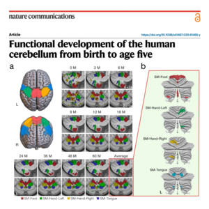 614-0至5岁儿童小脑功能发育图谱