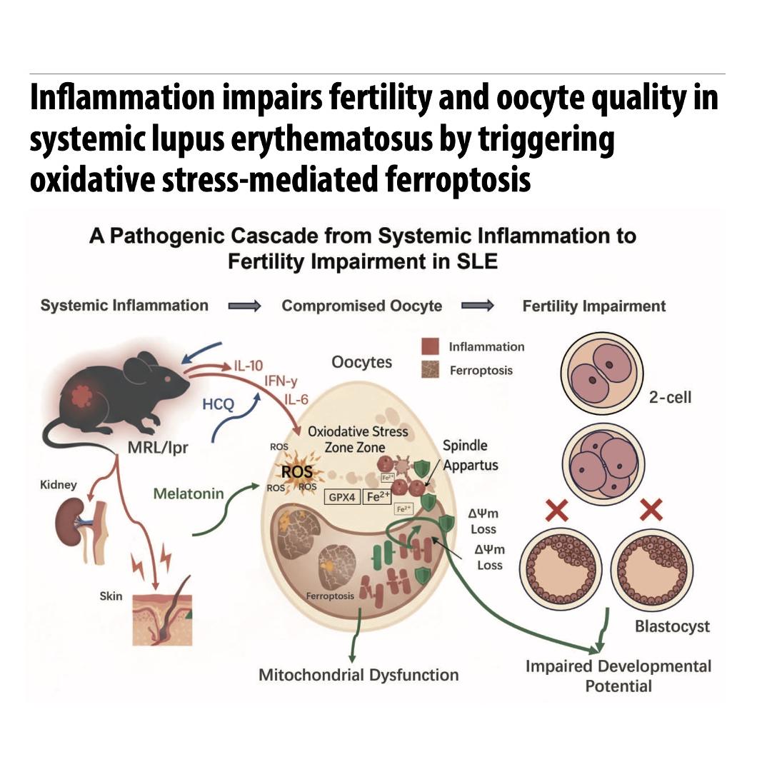 1420-Ferroptosis in Systemic Lupus Erythematosus episode artwork
