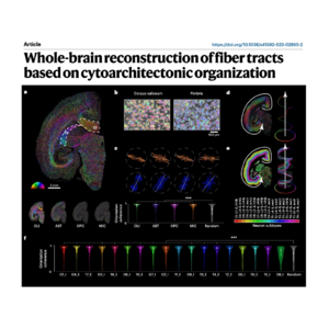318-Whole-brain reconstruction of fiber tracts
