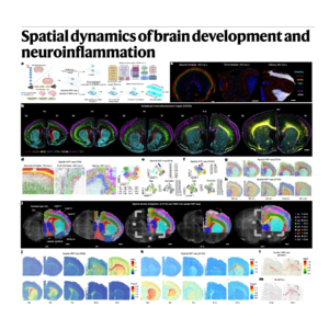 261-Spatial Atlas of Brain Development and Neuroinflammation